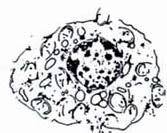1: Schematische Darstellung der morphologischen Veränderungen in apoptotischen Zellen und nekrotischen Zellen 184.