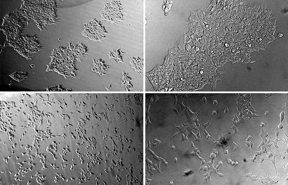 Ergebnisse A a B b C c D d Abb. 4.10: Wachstumsmuster stabil transfizierter HEK-293 Zellen. Zellen wurden mit dem Expressionsvektor ohne Insert (mock-transfektion; Bild A, B) bzw.
