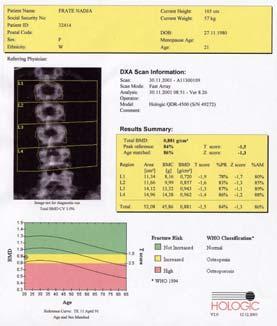 Körpergewicht - falsch niedrige BMD hohes Körpergewicht - falsch überhöhte BMD
