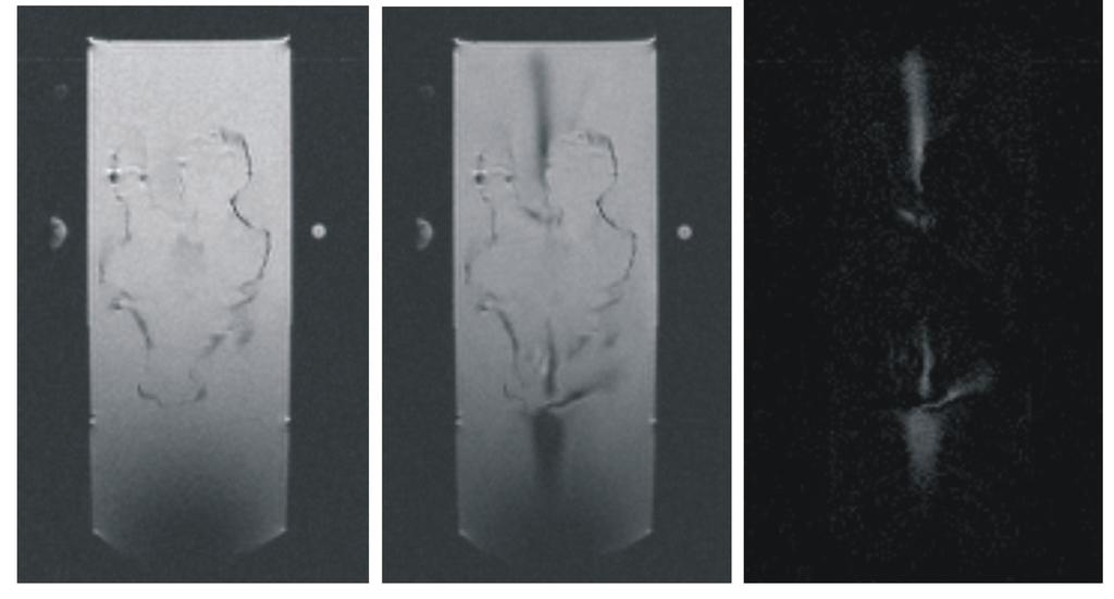 4.7. KOPFPHANTOM IM TOMOGRAPHEN 51 Abbildung 4.11: Diffusionsgewichtete Spin-Echo-Aufnahmen des Gewebephantoms ohne (links) und mit (Mitte) Ultraschalleinstrahlung.