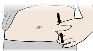 Spreiz-Methode Spreizen Sie Ihre Haut fest, indem Sie Ihren Daumen und Ihre Finger fest in