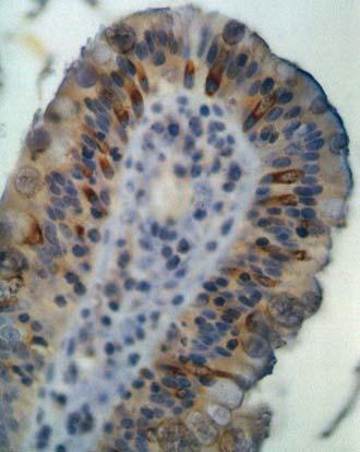 Graviditätswoche Rechts: Bildausschnitt aus dem Duodenum eines adulten Tieres Pfeile markieren EGF-positive Zellen EGF war im Zytoplasma der Gobletzellen lokalisiert, wobei alle aufgefundenen