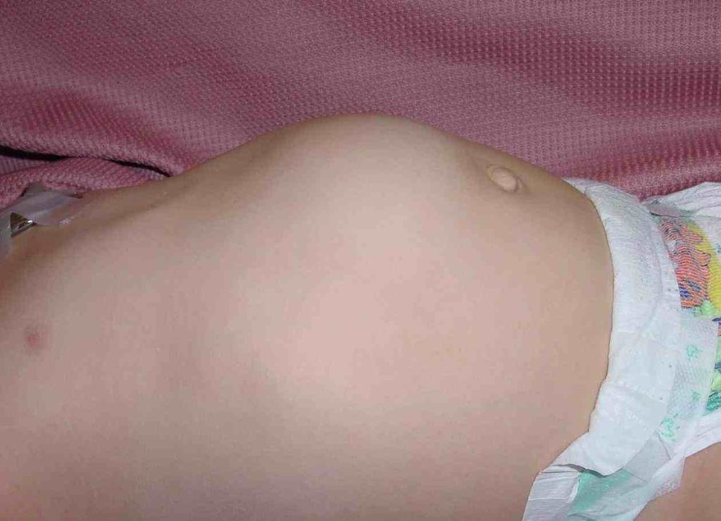 Arch Dis Child Fetal Neonatal Ed (2011) 296: F201-5 The "educated hand".