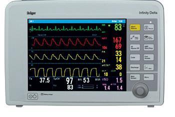 EEG Monitoring: Fehlerquellen Rohsignal muß sichtbar sein Kenntnisse der
