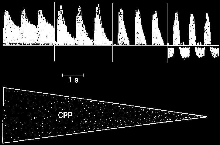 Transkranielle Dopplersonografie Flußprofil und -richtung Zerebraler Zirkulationsstillstand Blutstromgeschwindigkeit CO 2 -Reaktivität