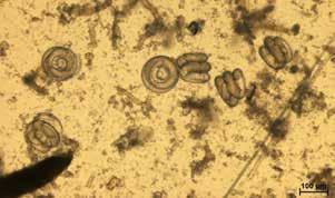 60 // 84 TRICHINELLOSE Die Trichinellose wird durch Larven von Rundwürmern vor allem der Art Trichinella (T.) spiralis verursacht. Diese Erreger werden als Trichinellen oder Trichinen bezeichnet.