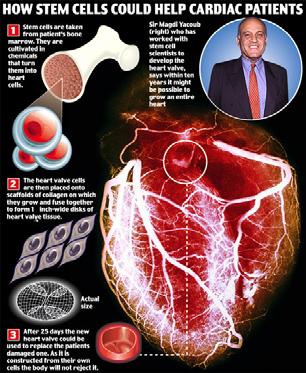 Heilungsversuche von Herzkrankheiten mittels Knochenmark-Stammzellen. Heilung von Krankheiten? Nach 18 Jahre noch immer kein Erfolg!