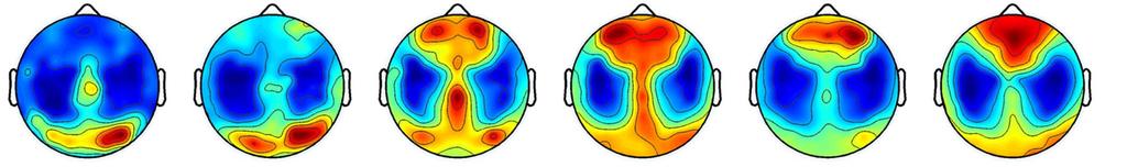 Langsamwellige EEG Aktivität Spiegel der neuronalen Plastizität 3 Jahre 7 Jahre 10 Jahre 13 Jahre 15 Jahre 18