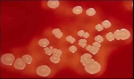 Gefahrenidentifikation Staphylococcus aureus Krankheitserreger be