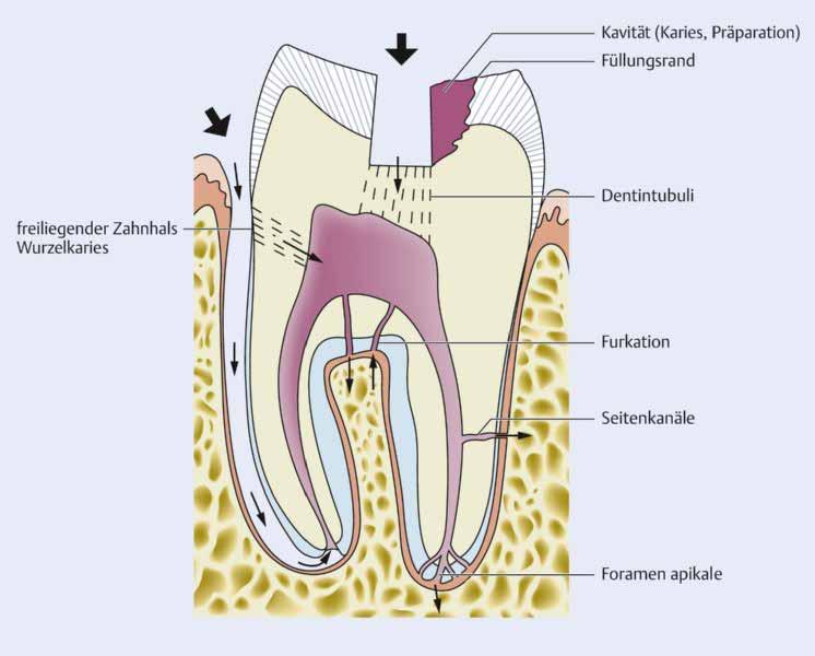 1 EINFÜHRUNG Erkrankungen des Endodonts und des apikalen Parodonts Abb. 1.