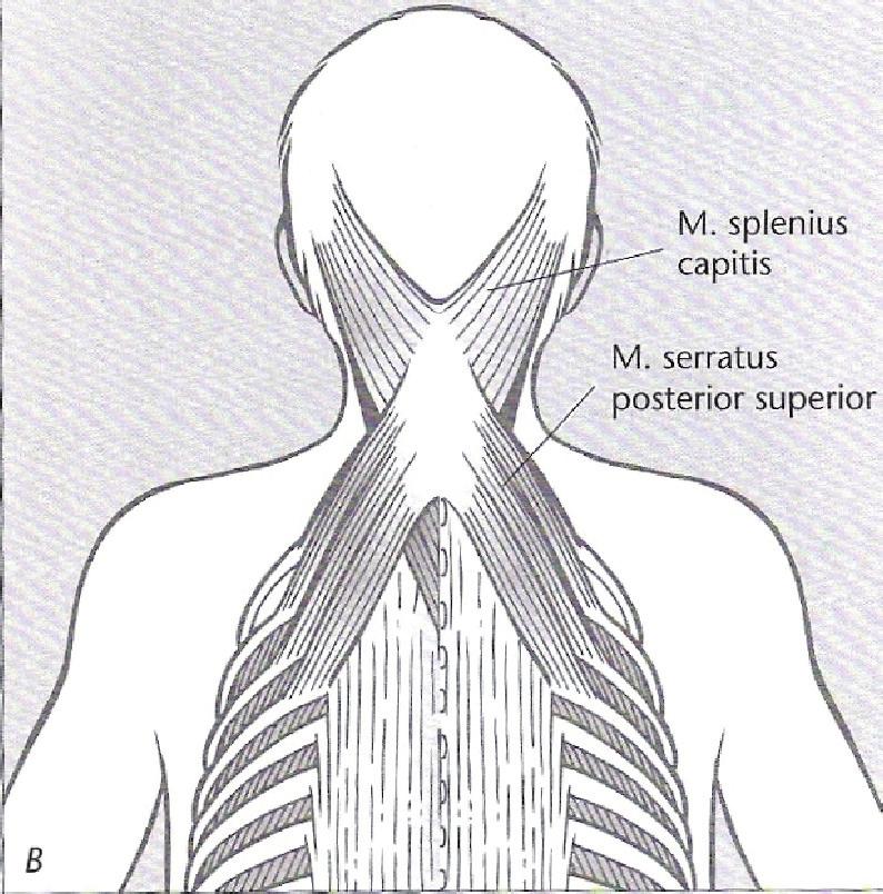 über die Processus spinosus (A) hin zu den Mm. rhomboidea, die zur Skapula ziehen.