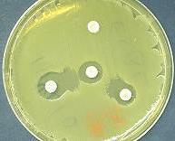 etc.) - Acinetobacter baumannii - Pseudomonas aeruginosa Relevante Resistenzen: -