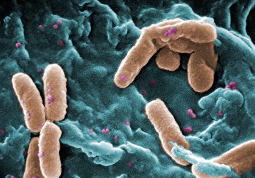 Das erste Antibiotikum: Pyocyanase Beobachtung (2. Hälfte des 19.