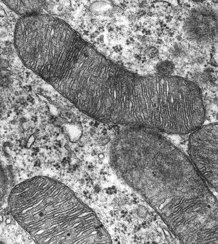 Mitochondrien vom crista-typ und vom tubulus-typ Die innere Mitochondrienmembran ist stark