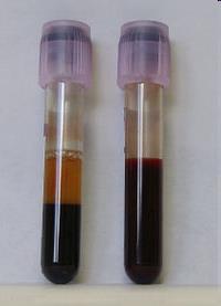 Zelluläre Elemente: Rote Blutkörperchen (Erythrozyten) gebildet im roten Knochenmark, Durchmesser 7-8 μm, Zellendicke -3 μm, 4-5 0 6 /mm³ Weiße Blutkörperchen (Leukozyten) Ort der Entstehung: rotes