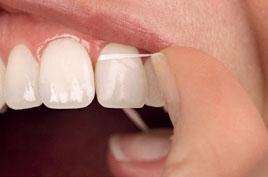 FOKUS Abb. 4 Abb. 5 Abb. 6 Abb. 4 Abb. 5 Abb. 6 Dental Tape bei gesunden Verhältnissen. Gel wird am besten mit IDB appliziert. Dental Picks sind auch unterwegs sehr praktisch. reinigen.
