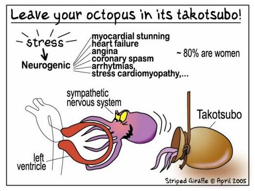 TakoTsubo-Kardiomyopathie apical