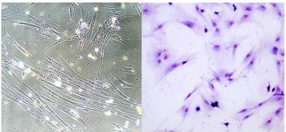 4.6 Zellkomposition und Chimärismusanalyse 4.6.1 Stromazellformationen in vitro Native Zellen: Die Stromazellkulturen wurden morphologisch zunächst nativ, d.h. ohne Verwendung von Immunfluoreszenzfärbungen spezifischer stromaler Marker wie Vimentin oder von-willebrand-faktor betrachtet.