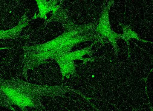 Vimentin (grün) Abbildung 7: Stromazellen mit