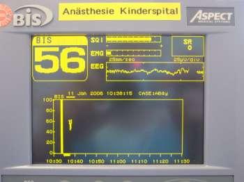 Weniger Inhalationsanästhetika Hypnose-Monitoring 36 Kinder 4-18 J mit 0.62 12 n MAC von Halothan gesund 0.