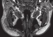 Bildgebung der Speicheldrüsen Christian Czerny Die Kopfspeicheldrüsen werden unterteilt in die großen Kopfspeicheldrüsen und in die kleinen Kopfspeicheldrüsen.