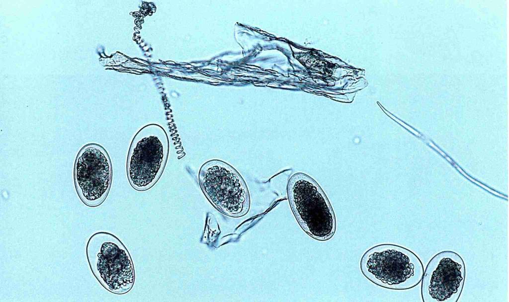Im Mikroskop können die mit dem Kot ausgeschiedenen Magen-Darm Wurm Eier sichtbar gemacht und gezählt werden Daraus lässt sich die Anzahl parasitierender Würmer im Tier schätzen. (Bild.