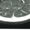 image MRI From Picture to