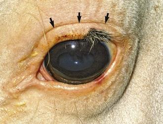 NEBENORGANE DES AUGES (ORGANA OCULI ACCESSORIA) PALPEBRA SUPERIOR et INFEROIR: bei geöffneten Lidspalten am oberen Augenlid Lidfurche (SULCUS