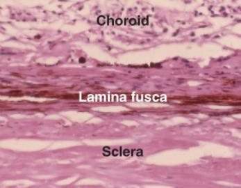 TUNICA FIBROSA BULBI (ÄUβERE AUGENHAUT) LAMINA FUCSA SCLERAE: durch Melanozyten bedingte Pigmentierung besteht aus: einer dünnen Lage scherengitterartig angeordneter