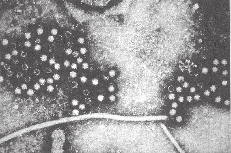 Hepatitis E Virus Infektionen Virus information: Virus family: Caliciviridae or Hepeviridae (Emerson et al.