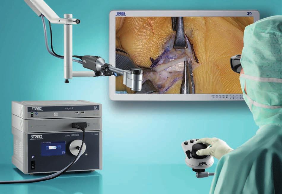 VITOM 3D 3D-Visualisierung für die Handchirurgie und die plastische Chirurgie Das VITOM 3D-System stellt eine revolutionäre Lösung für die Visualisierung von mikrochirurgischen und offenen Eingriffen