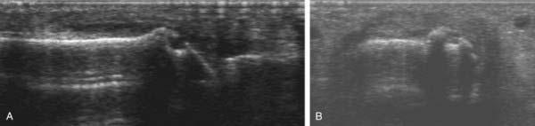 Sonographie, ein Baustein in der Diagnostik