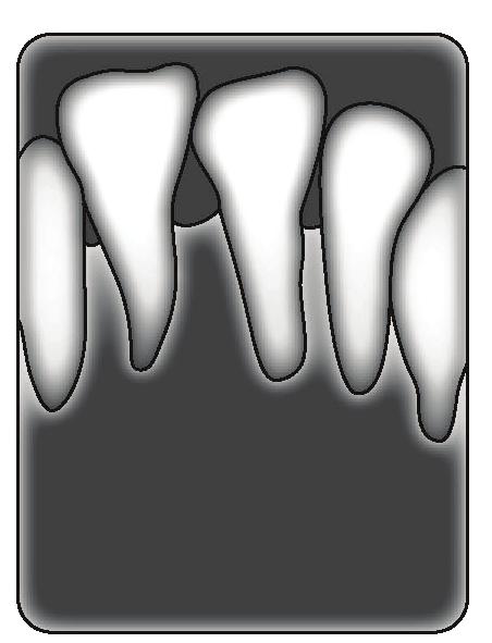 Aussage richtig falsch a) Die Bilddarstellung wird grössenrichtig. b) Die dargestellten Zähne werden verzerrt abgebildet.