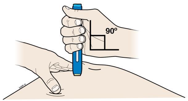 ODER Drückmethode Drücken Sie die Haut fest zwischen Ihrem Daumen und Ihren Fingern zusammen, um eine etwa 5 Zentimeter (2 Zoll) breite Fläche zu bilden.