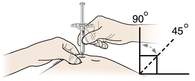 F. Drücken Sie Ihre Injektionsstelle zusammen, um eine feste Oberfläche zu erzeugen.