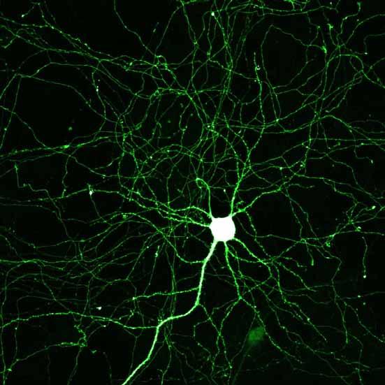 Nervenzellen unter dem Mikroskop Eckhard Friauf