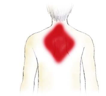 Schmerzen im Brustkorb ist ein besonderes Alarmzeichen Achtung: Bei Frauen sind Atemnot,