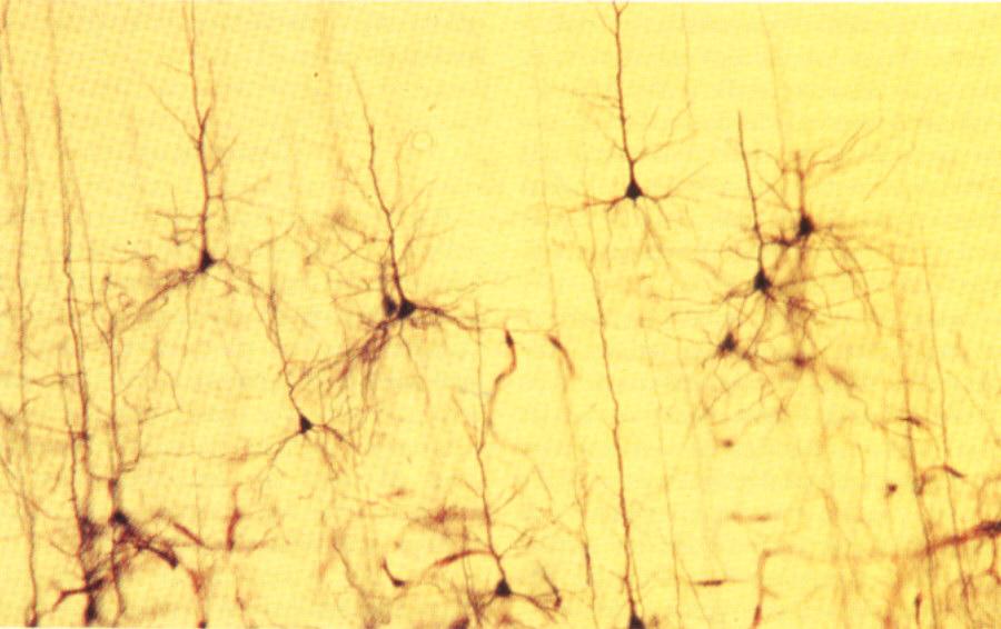 Experimenteller Nachweis von Einzelneuronen Der spanische Neuroanatom Santiago Ramon y Cajal konnte um 1905 mittels der Golgi-Färbung erstmals nachweisen, dass das Gehirn aus einzelnen,