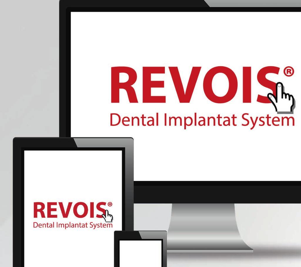 Vorteilen des REVOIS Dental Implantat