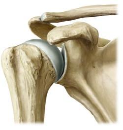 Obere Extremität 1 Knochen, Bänder und Gelenke 1.13 Schultergelenke: Articulatio humeri, artikulierende Gelenkflächen, Gelenkkapsel und Gelenkhöhle Proc.