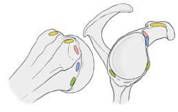 nach Entfernung des Humeruskopfes und Durchtrennung der Kapsel sowie der Ansatzsehnen der Rotatorenmanschettenmuskeln, Ansicht von lateral; c Ursprung und Ansatz der Bandstrukturen.
