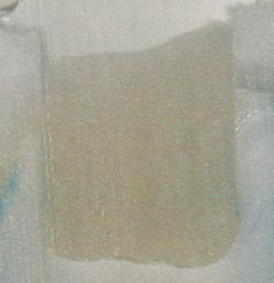 Penetration des Farbstoffes erkennbar; die Pfeile weisen auf den Rand der Restauration. Abb.