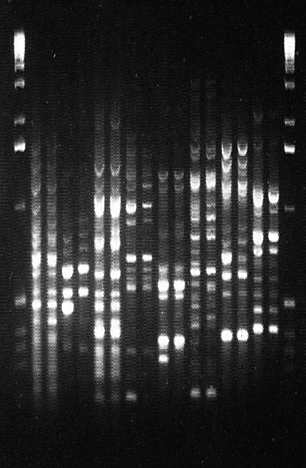 Auftrennen von DNA-Fragmenten Agarose-Gel zur Trennung verschieden langer