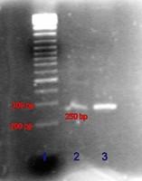 Schritte des PCR-Prozesses Verlängerung (elongation). Die Temperatur für ca. 30 Sekunden je 500 Basenpaare auf 68-72 C (je nach Polymerase) halten. Die Schritte 2-4 werden 25-40 mal wiederholt.