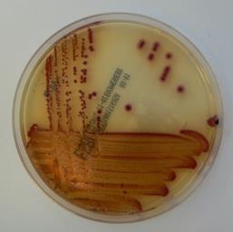 Schematischer Ablauf im Labor Stuhlprobe / Rektalabstrich Kultur auf chromid TM ESBL Agar Wachstum von gramnegativen Bakterien mit verminderter Empfindlichkeit