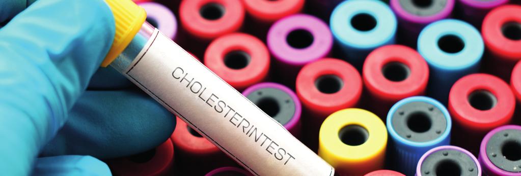 HDL-Cholesterin (High Density Lipoprotein) ist ebenfalls eine Eiweiß-Verbindung. Im Gegensatz zum LDL schützt es aber die Gefäßwände vor Verkalkung.