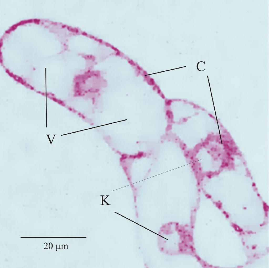 Methoden 38 Abbildung 2-6: Zelluläre Verteilung des BODIPY -markierten Ether-Lysophospholipides BELPC. Zellen (mikroskopisches Präparat nach 3.5.1) 2 min nach Zusatz von 2 M BELPC.