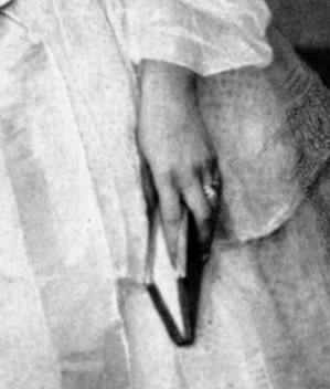 Sie trägt auch zwei Ringe jeweils an den Ringfingern. Historische Fotos aus den 1860er Jahren zeigen sie ebenfalls mit solchen Ringen an den Fingern.