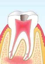 Endodontie (orthograd) Endodontie (retrograd) Dr.
