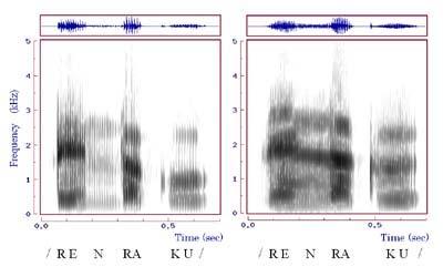 Oszillogramm Sonagramm Schall-Spekrogramm (voiceprin) Herzöne in Zei-Frequenz Darsellung (+ Oszillogramm) (s) sinus (Hz) Zei Frequenz Darsellung (s) gesprochene